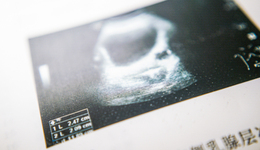 药王的终极考验：诊断工具，你准备好了吗？