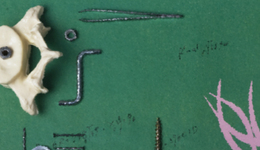 創(chuàng)業(yè)板IPO折戟后改道北交所，愛得科技受“帶量采購”影響業(yè)績陡降