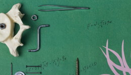 IPO雷达｜乐普医疗入股的海金格冲北交所：销售费用率高于同行，关联交易受关注