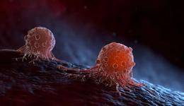 小细胞癌攻坚50年：起风，加速，再加速