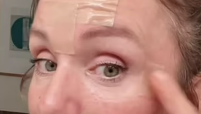 疤痕体质,日化,消费