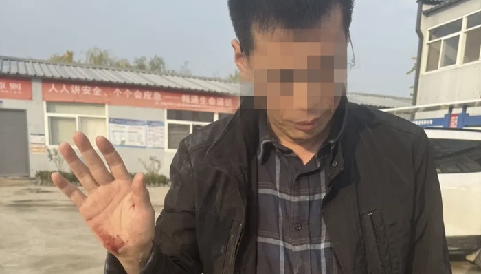 两记者在安徽采访被打,刚报道铁路建设存安全隐患,中记协发声