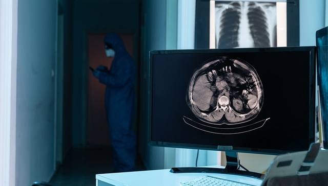 国产医疗AI模型首次被美国认定为“突破性医疗器械”