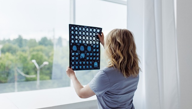 耗材集采后国产医疗器械公司开始业绩放量