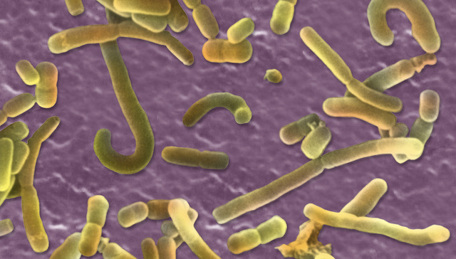 香港公立医院疑出现医生群体感染产志贺毒素大肠杆菌，已有一人离世