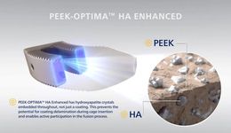 医用PEEK突破背后，复合应用是未来的发展方向