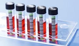 血制品迈入超级资本时代