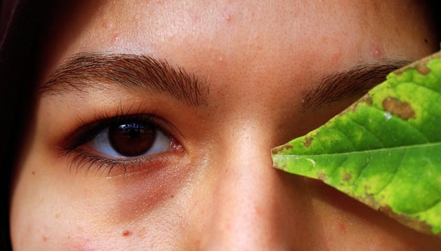 护肤品,痘肌护理,