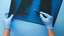 魏则西离开后，医疗陷阱的100种方式