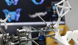 全球近600亿赛道爆发，国产骨科机器人如何啃下海外93%市场蛋糕？