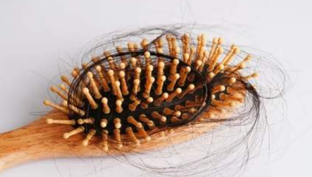 蔓迪国际,脱发,