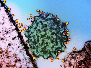 印度尼帕病毒疫情带飞个股，专家称传播性相对有限