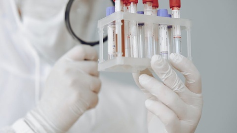 6个月生存率达到100%？Pan-(K)RAS被提前的下半场