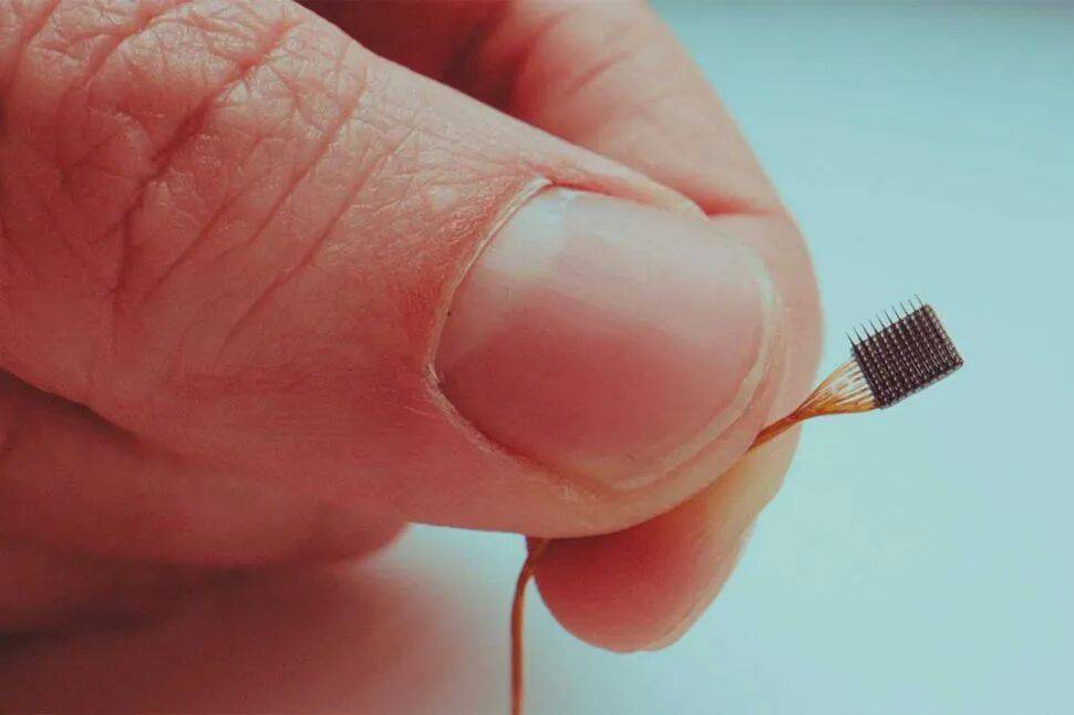 Blackrock’s Brain Implant BCI Lets Paralysis Patients Move and Feel ...