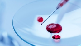 地方新闻精选 | 杭州共用采血针事件涉事员工被开除 安庆22岁女大学生被害案二审开庭