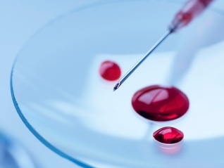 地方新闻精选 | 杭州共用采血针事件涉事员工被开除 安庆22岁女大学生被害案二审开庭