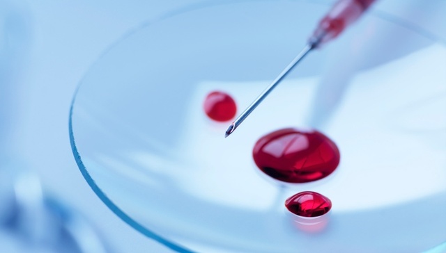 地方新闻精选 | 杭州共用采血针事件涉事员工被开除 安庆22岁女大学生被害案二审开庭