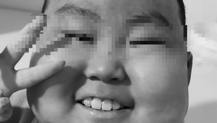 法治面;10岁抗癌男孩;去世;网暴;平台;升级屏蔽规则