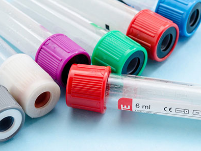 爱科百发,科创板,IPO