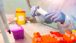 医疗器械指数ETF(159898)顽强收平，机构称医疗器械有望成2024年重要主线之一