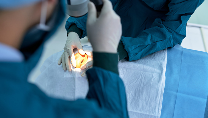 全国首例！美中嘉和(2453.HK)旗下广州泰和肿瘤医院成功实施脉络膜恶性黑色素瘤质子保眼治疗