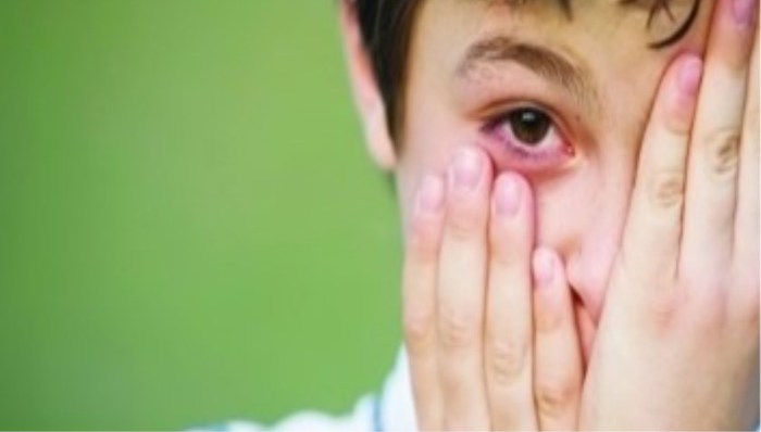 健康科普 | 幼儿眼睛受伤后急救常识