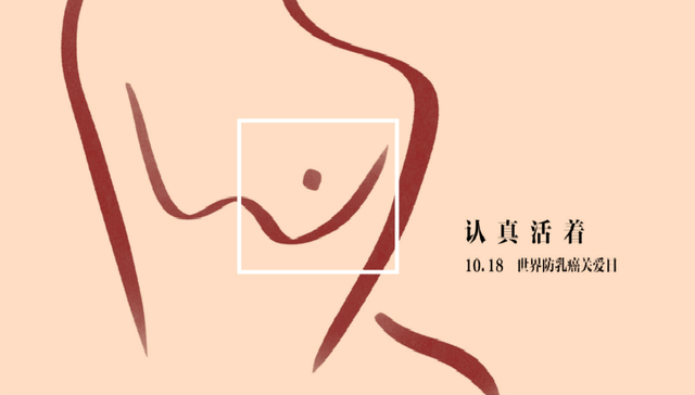 女性,癌症,乳腺癌