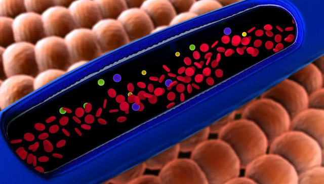 糖尿病,胰岛素,医学