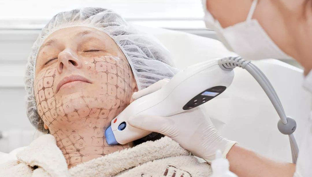 热玛吉,医美,行业趋势