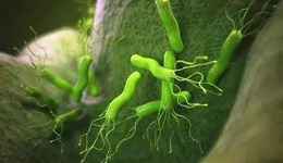 拒絕幽門螺桿菌感染，從打破圍餐開始