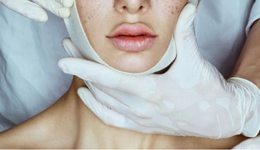 医美行业，收留35岁大厂失意者