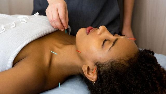 针灸,亚裔文化