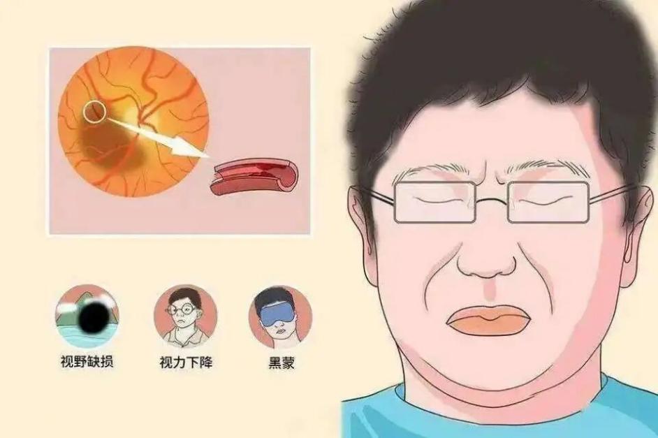 眼睛突然看不见?当心“生命线”危机!合肥普瑞眼科深度解读突发性失明|界面新闻